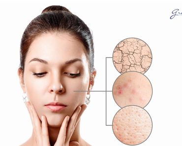 Restoring Damaged Skin: Tips for Healthy and Radiant Skin